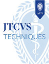 JTCVS 技術